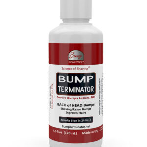 BUMP TERMINATOR Severe Bumps Treatment and Dark Spot Corrector | Razor Bumps And Ingrown Hair Treatment | Bikini Bumps And Ingrown Hair Treatment | Hyperpigmentation Treatment, 4 Oz